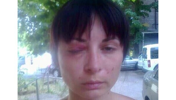 Пытки на Украине: куда смотрит ОБСЕ Пытки на Украине: куда смотрит ОБСЕ