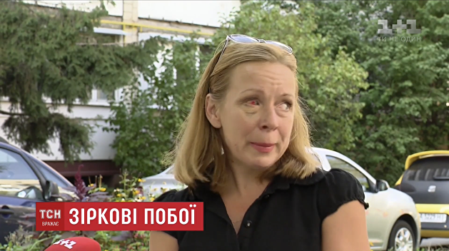 Избитая актером Кошелевым женщина рассказала о своем состоянии Избитая актером Кошелевым женщина рассказала о своем состоянии