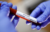 В Белоруссии зафиксировали первый случай заражения коронавирусом