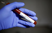 На Украине подтвердили почти 200 случаев заражения коронавирусом