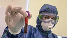 На Украине разрабатывают тест, который позволит отличить грипп от коронавируса