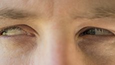 Отеки, спазмы и не только: врач рассказала о серьезных последствиях COVID-19 для глаз