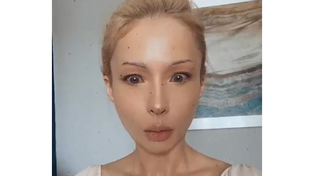 Бессмертная Барби из Одессы ужаснула реальной внешностью