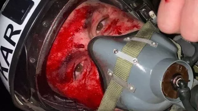 Как русские летчики оскорбили Белый лом и почему украинский летчик носит шлем фашиста