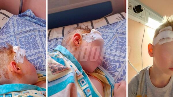 Дети мигрантов пробили череп 6-летнему ребенку в Твери