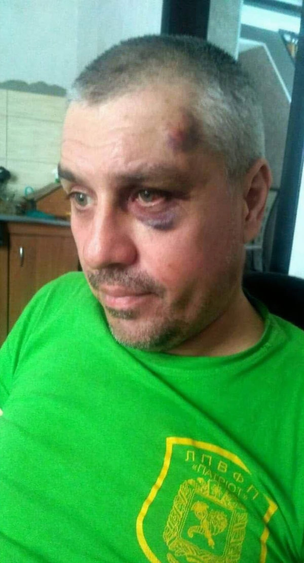 Вячеслав Артюхов со следами побоев