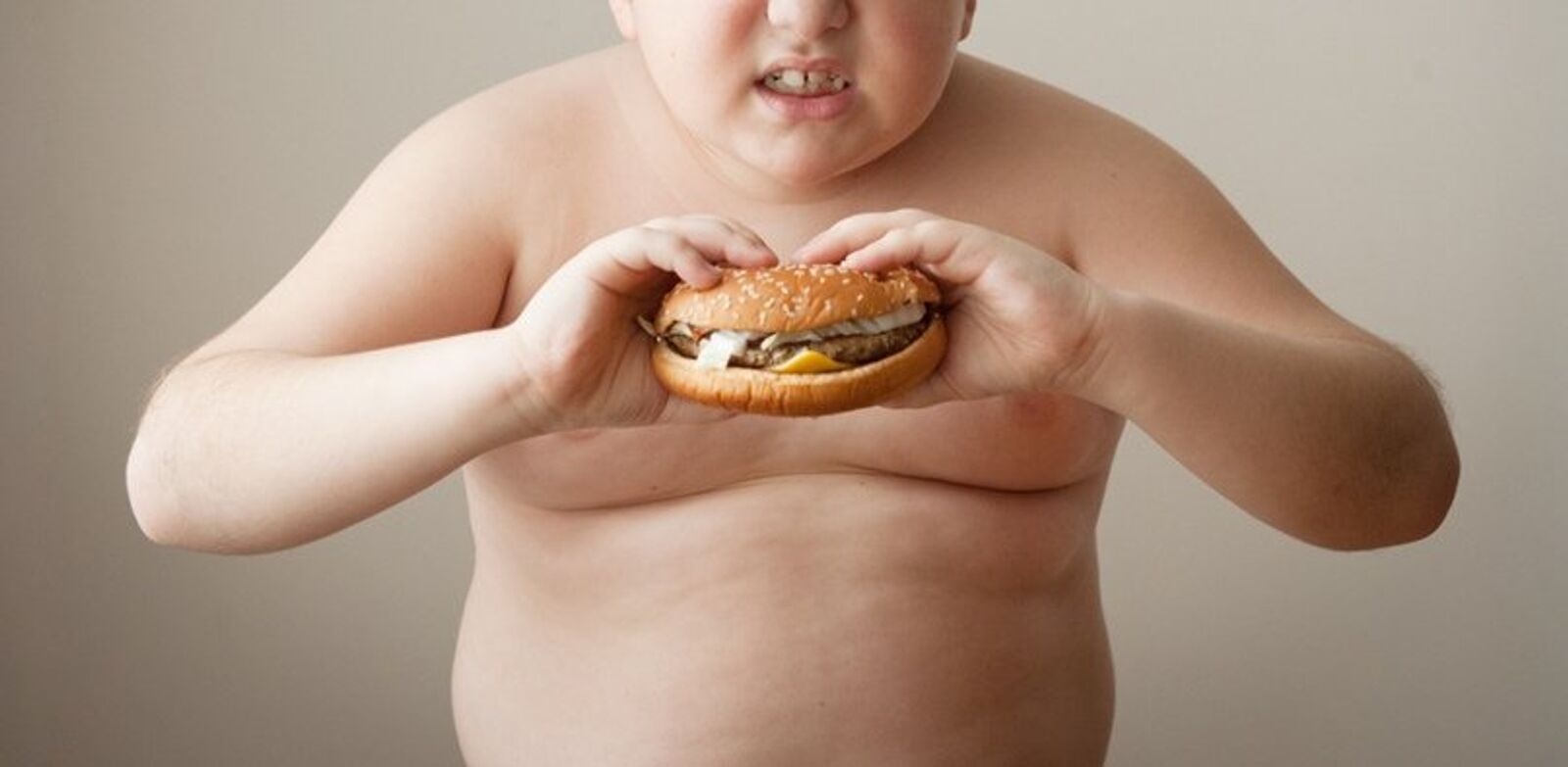 Лишний вес у подростка. Ожирение у детей и подростков. Дети с СС ожирением.